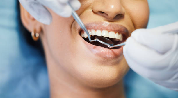 Best Emergency Treatment for Dental Infections or Abscesses in Bovina, TX