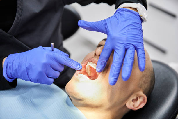 Best Emergency Tooth Extraction in Bovina, TX